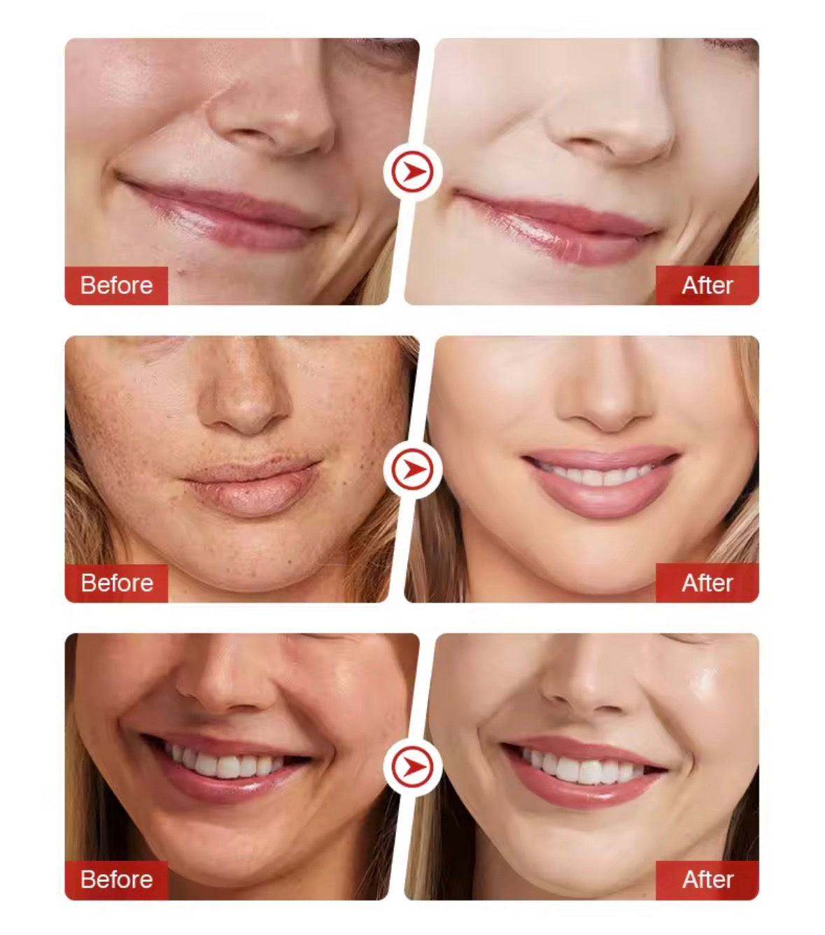 Sérum XUEYI à la niacinamide 10% et à l'acide tranexamique 4% pour éliminer les taches brunes
5.0